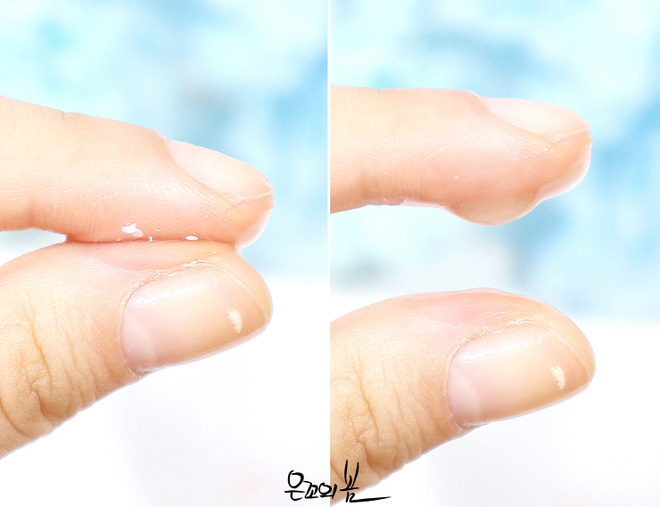 Gel lô hội đúng là
