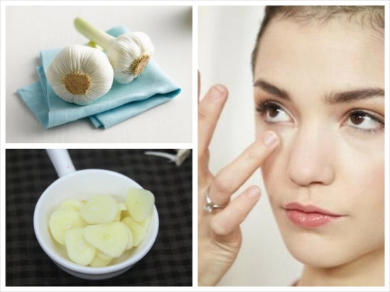 Một số phương pháp trị mụn tại nhà đơn giản và không tốn kém