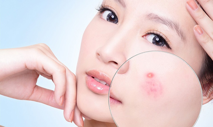 Tại sao phải sử dụng sữa rửa mặt?