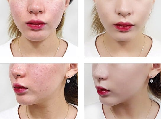 Review phấn nước ma thuật April Skin và những cách đơn giản phân biệt phấn nước April Skin thật giả