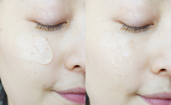 Gel lô hội đúng là