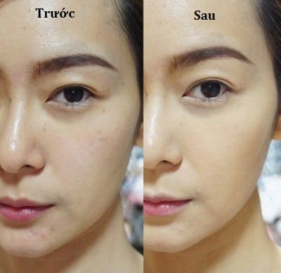Phấn nước là gì? Phấn nước loại nào tốt?