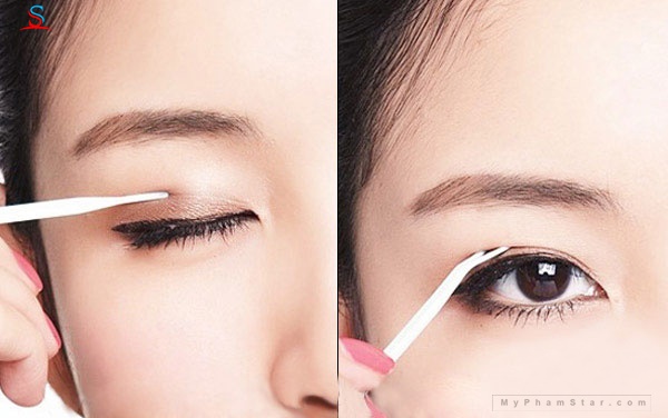 kích mí lưới Keli 4
