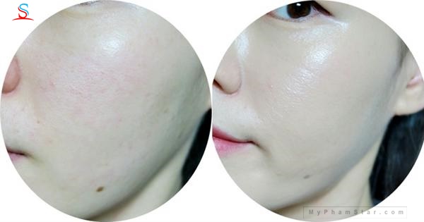 Phấn nước LIME CUSHION xanh 4
