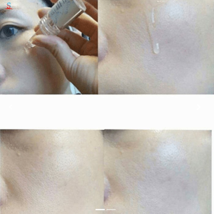 Serum tái tạo da Elravie Derma White Brightening Ampoule 4