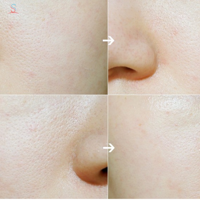 Nước hoa hồng trắng da Innisfree whitening pore skin 3