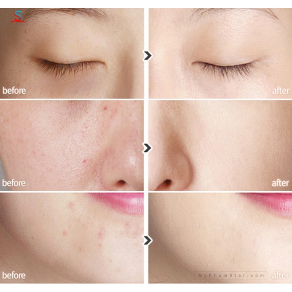 Son che khuyết điểm 2 đầu Face It 4