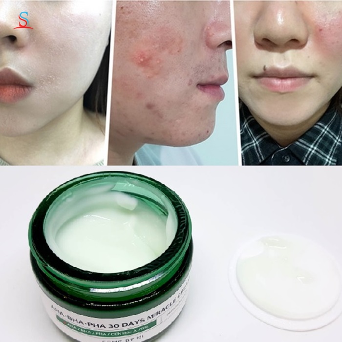 Kem Dưỡng Trị Mụn Some By Mi AHA-BHA-PHA 4