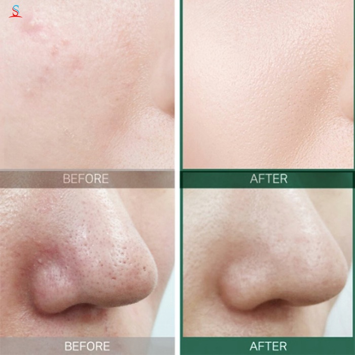 nước hoa hồng trị mụn Some By Mi AHA BHA PHA 3